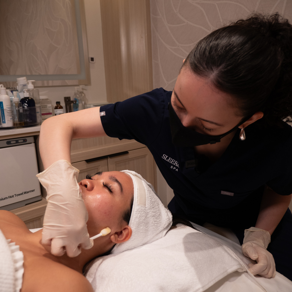 PCA Peels