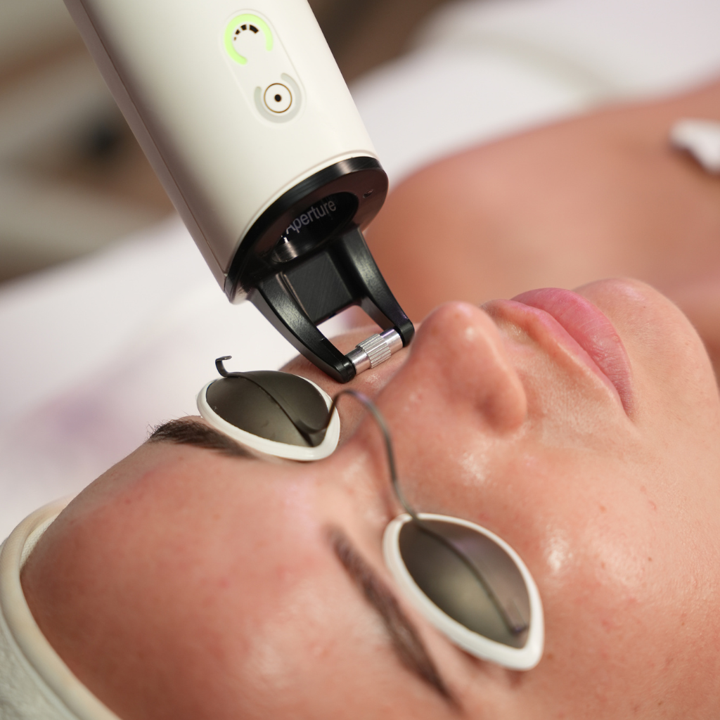 Laser and Microneedling