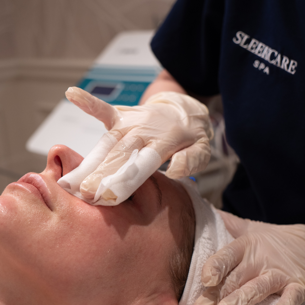 PCA Peels