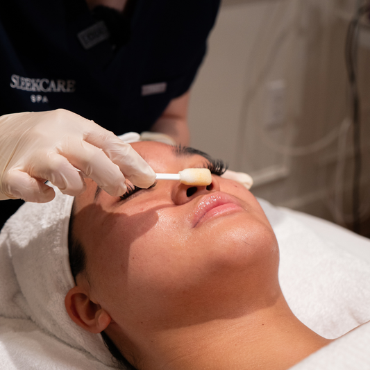 PCA Peels