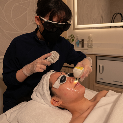 Candela Nordlys IPL Photofacial