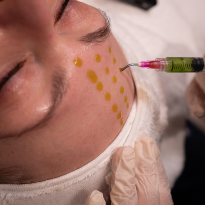 BioRePeel Chemical Peels