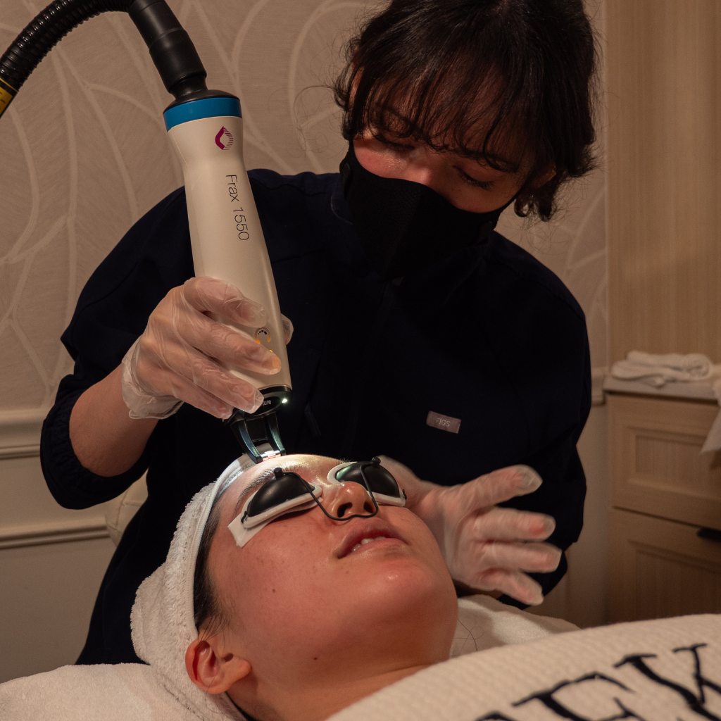 Candela Frax Laser Skin Resurfacing Treatment