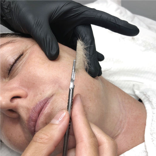 Dermaplaning