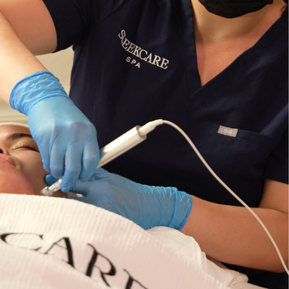 Candela Exceed Microneedling