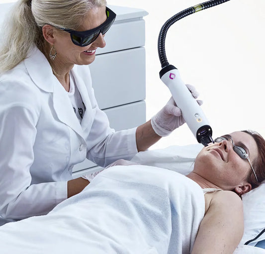 Candela Laser Skin Resurfacing Treatment