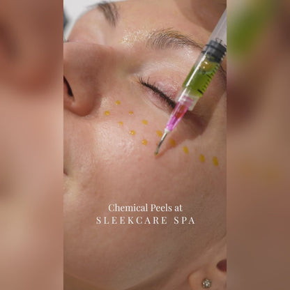 BioRePeel Chemical Peels