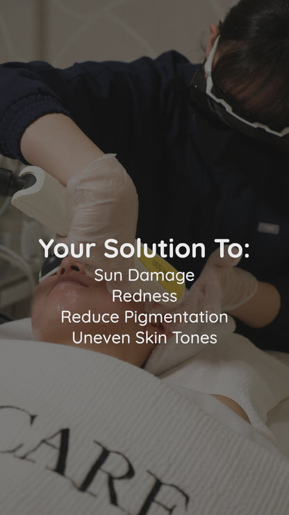 Candela Nordlys IPL Photofacial