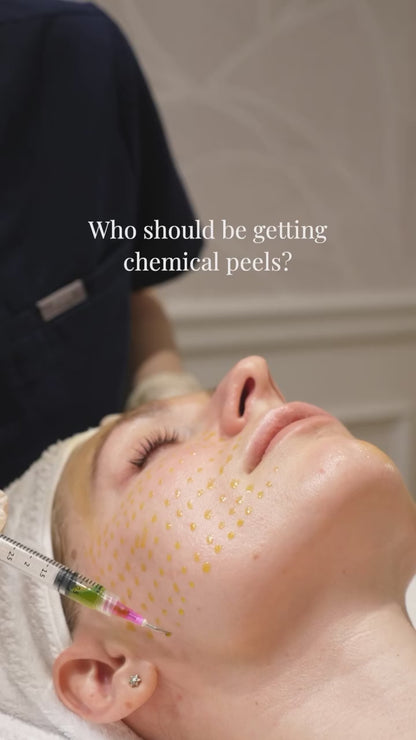 BioRePeel Chemical Peels